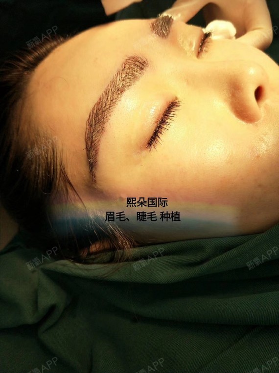 植眉重塑自信，探寻美丽转变之旅的眉毛魅力价格